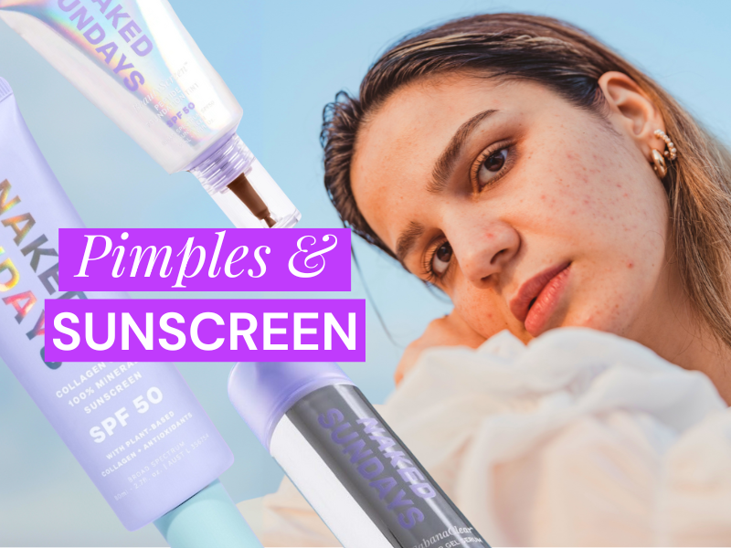 SPF for Pimple/Zit Prone Skin